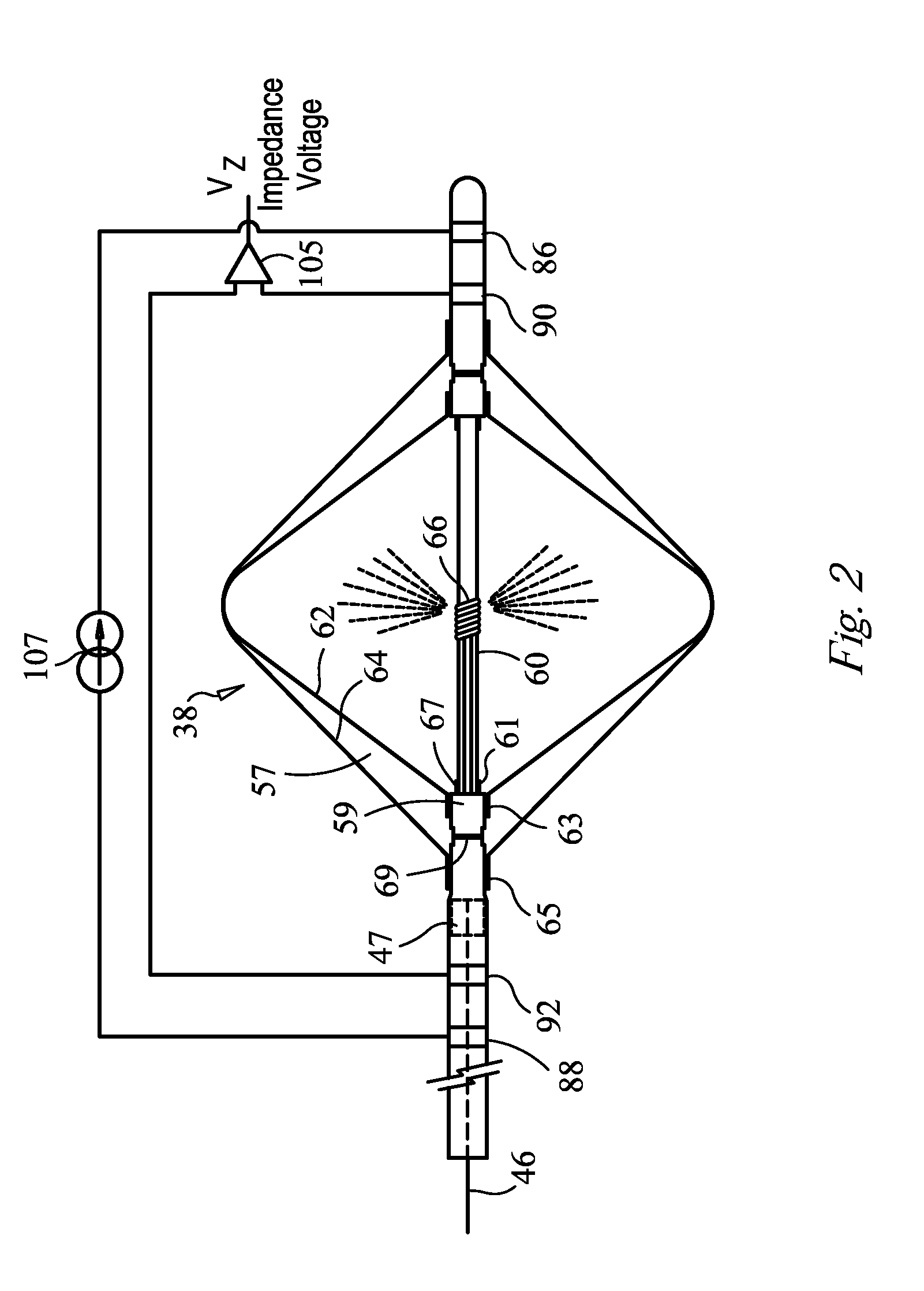 Bioimpedance measurement system and method