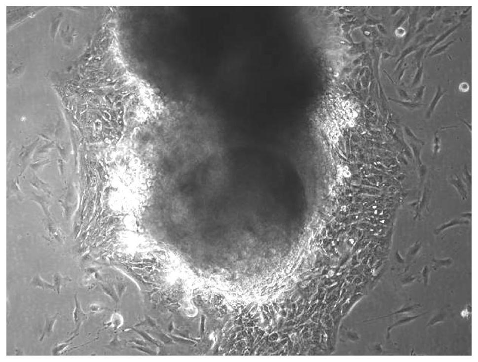 Epidermal cell culture medium and methods and applications for preparing fibroblasts and epidermal cells from the same tissue