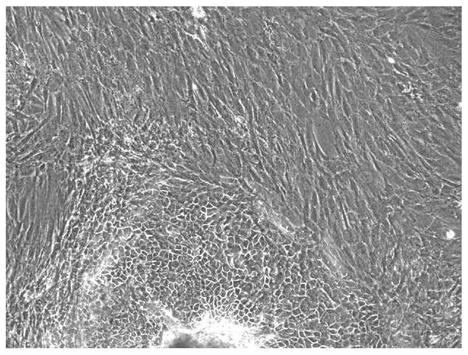 Epidermal cell culture medium and methods and applications for preparing fibroblasts and epidermal cells from the same tissue