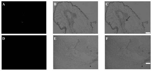 A transcription factor of root-knot nematode mgbtf3 and its application in disease control