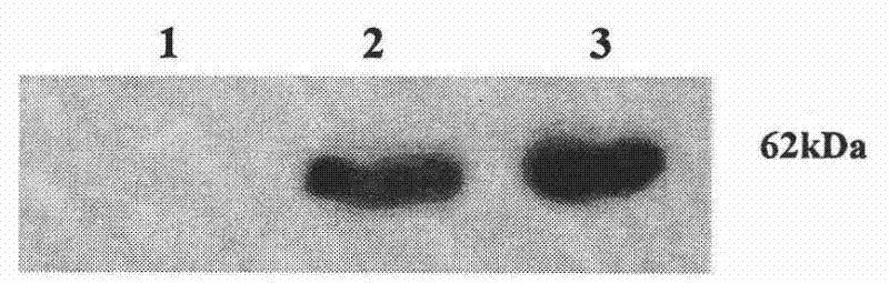 A kind of human cytomegalovirus ul49 gene antigen peptide, its antibody and application