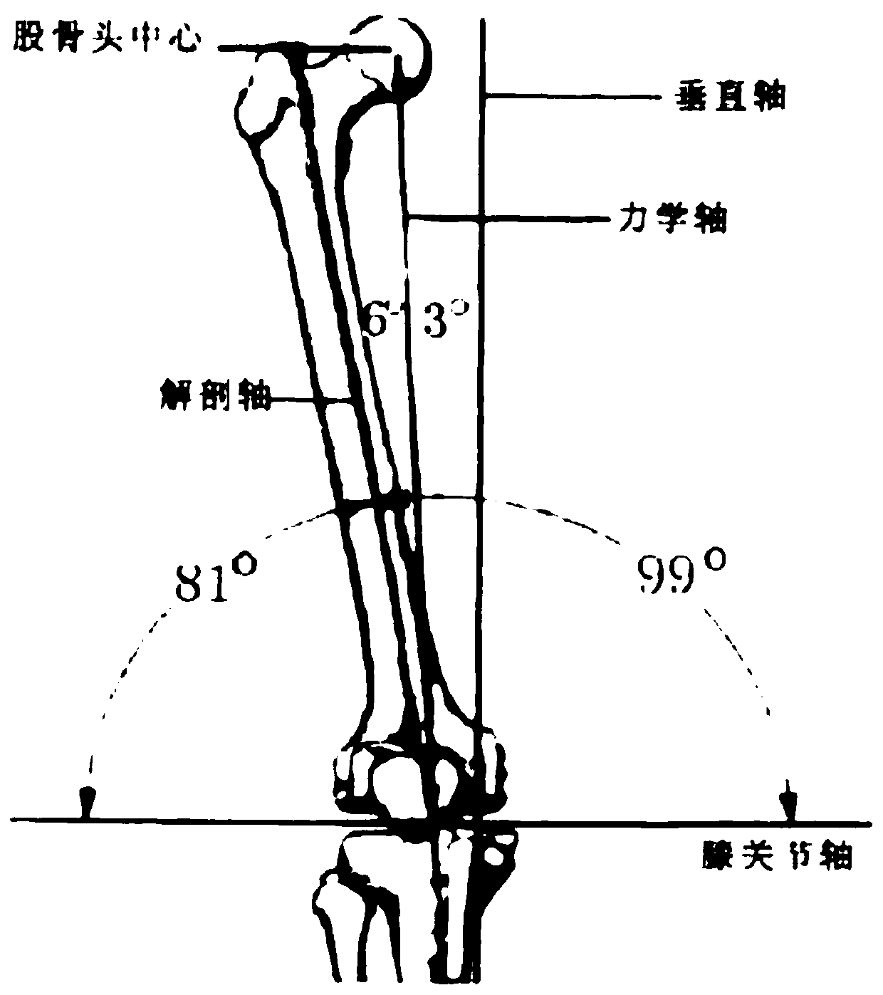 Full digital total knee arthroplasty robot system and its simulated surgical method