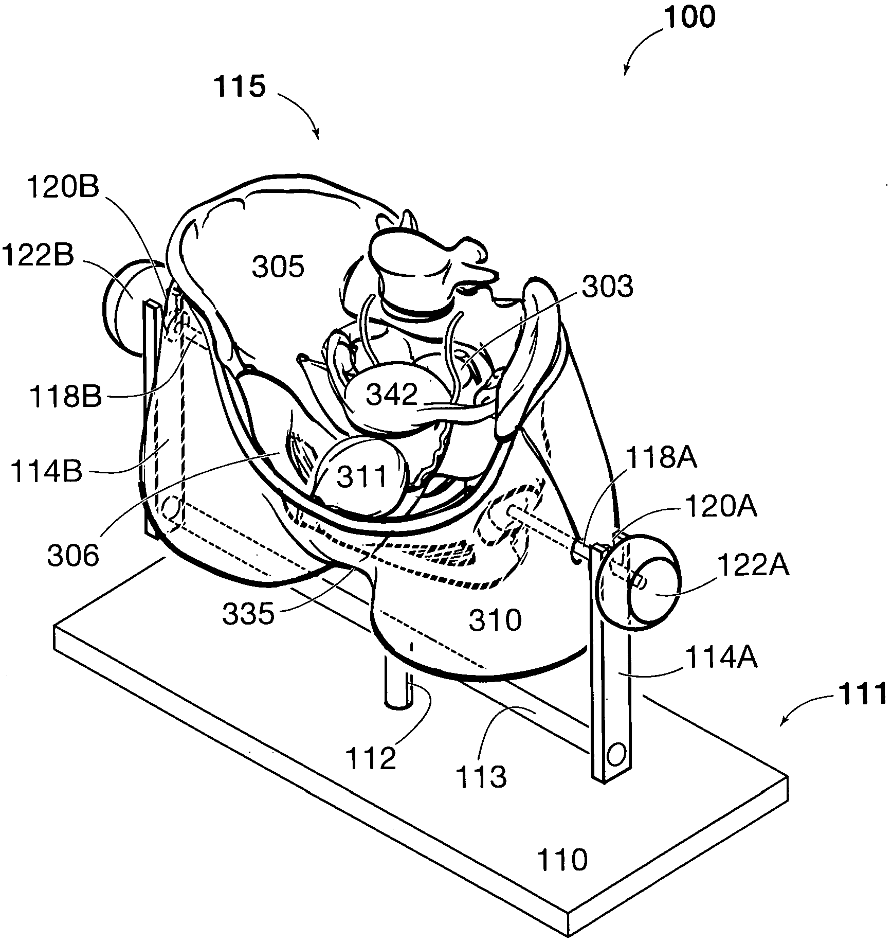 Pelvic Surgery Training Model