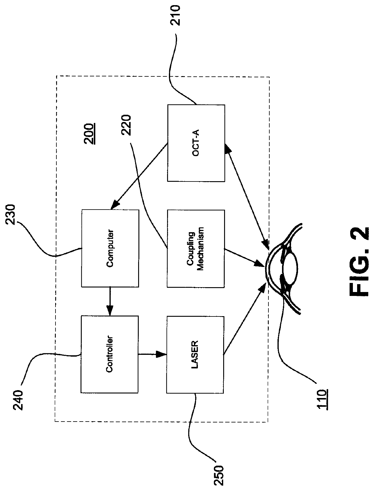 Method and system for laser automated trabecular excision