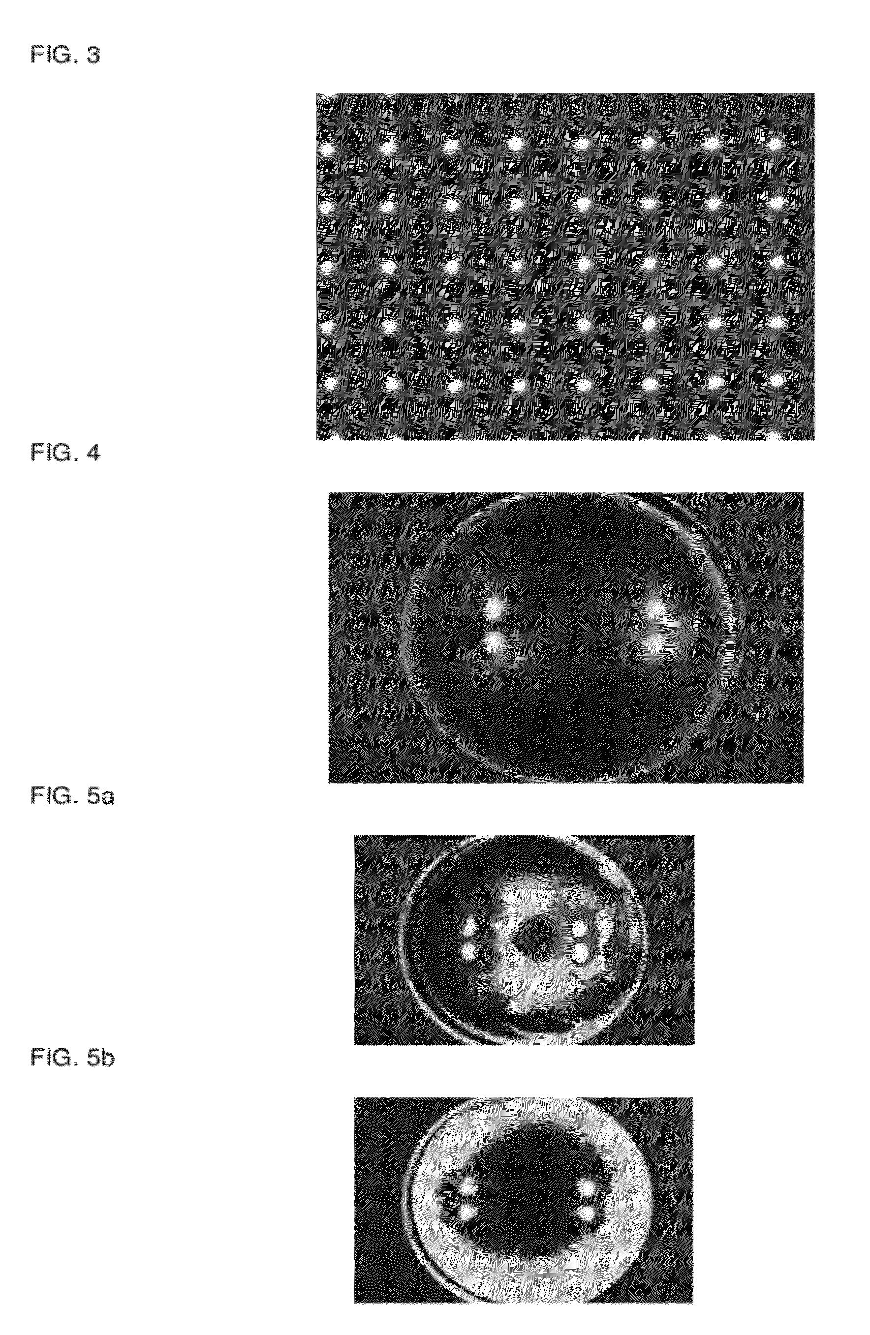 Automatic Refracto-Keratometer