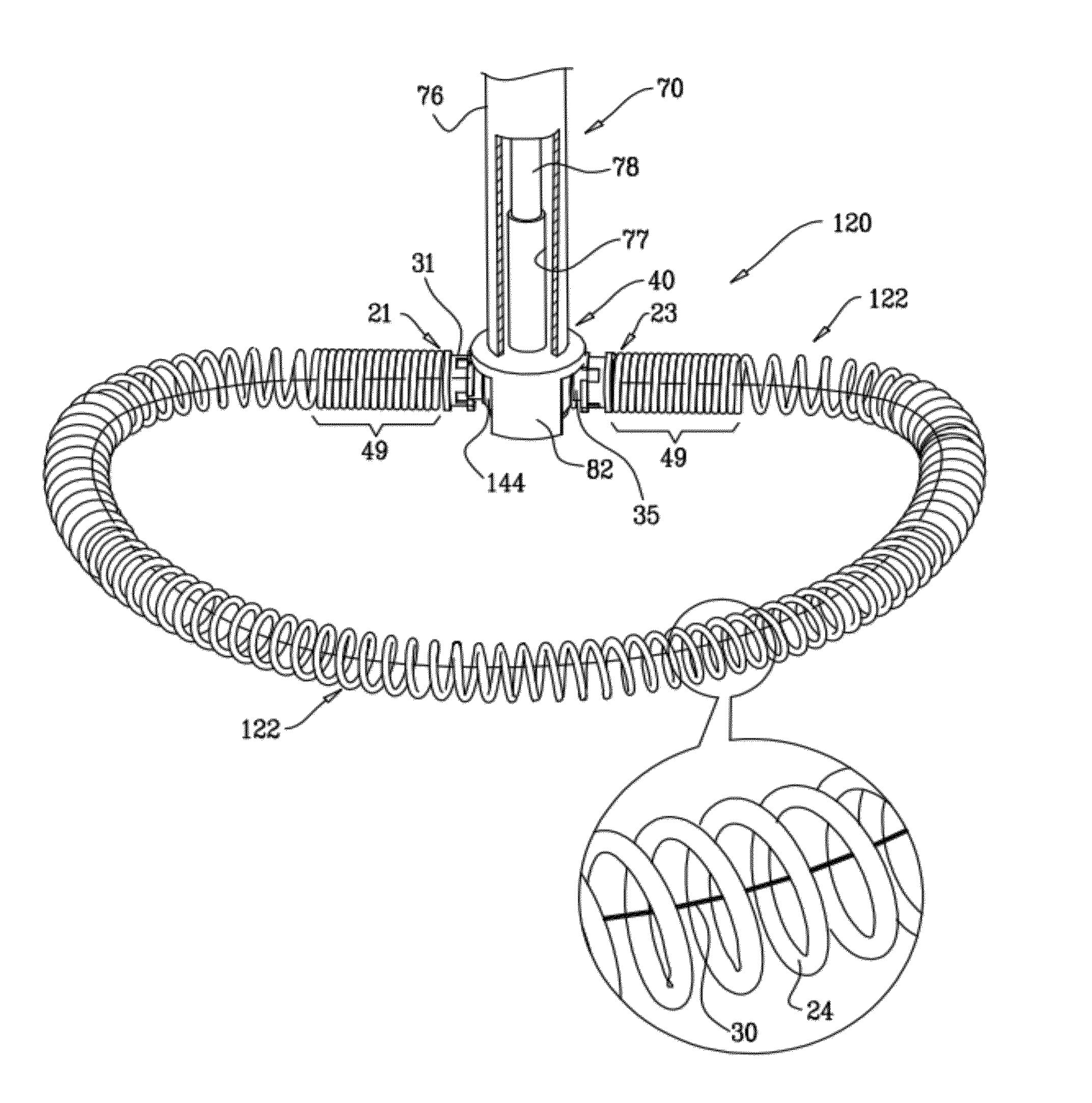 Adjustable partial annuloplasty ring and mechanism therefor