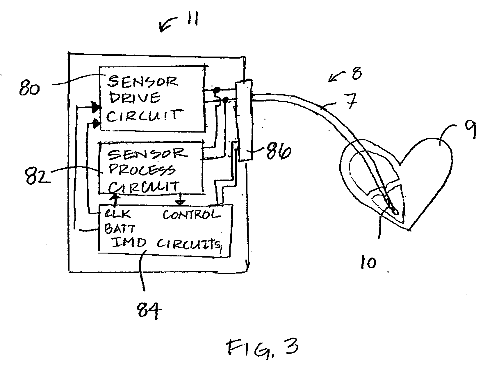 Normalization method for a chronically implanted optical sensor