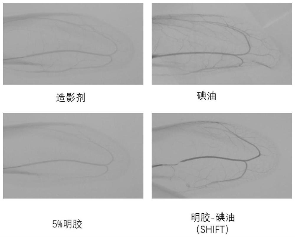 Preparation method and application of injectable gelatin-iodized oil homogeneous preparation for vascular embolism