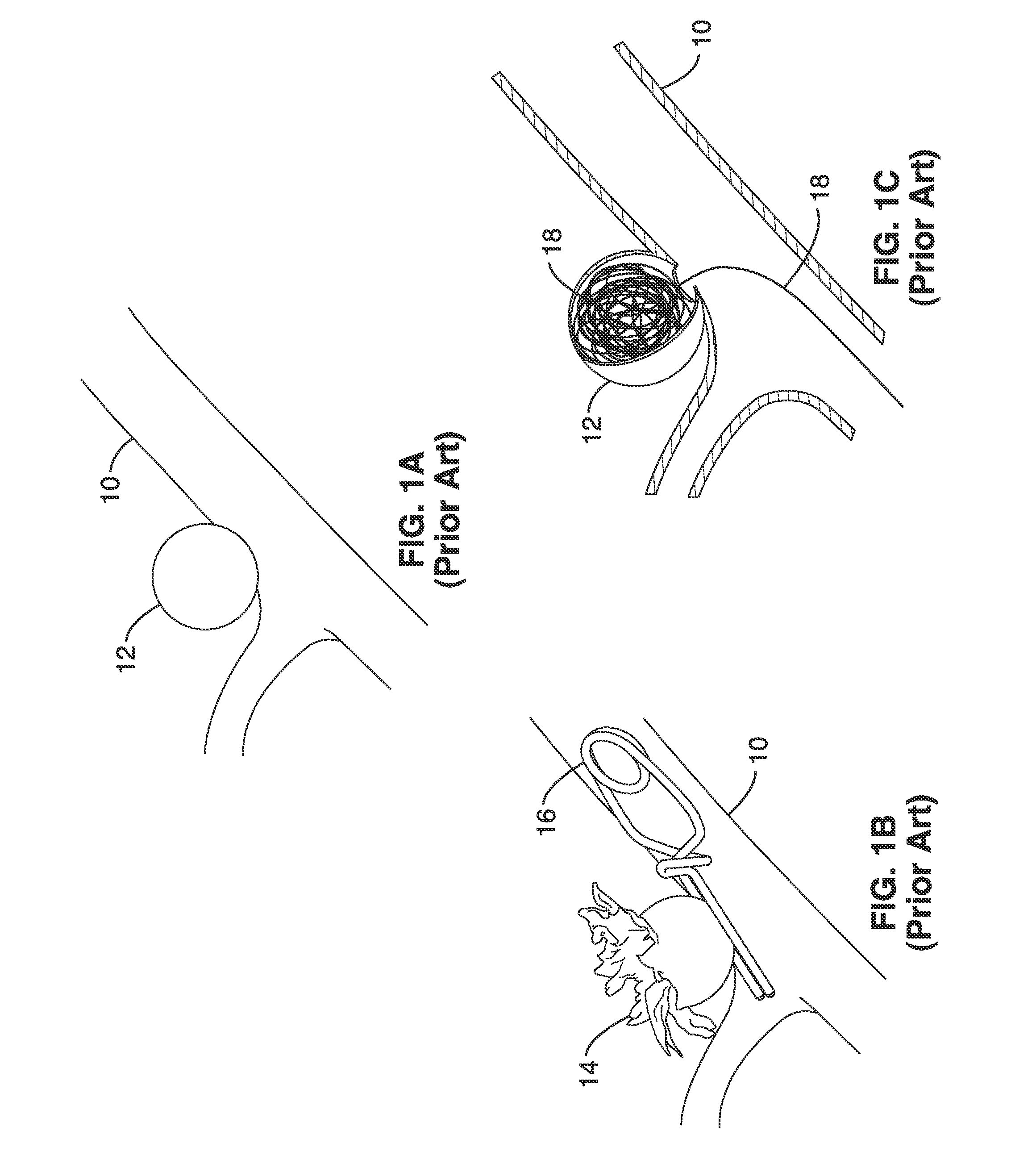 Thin film vascular stent and biocompatible surface treatment