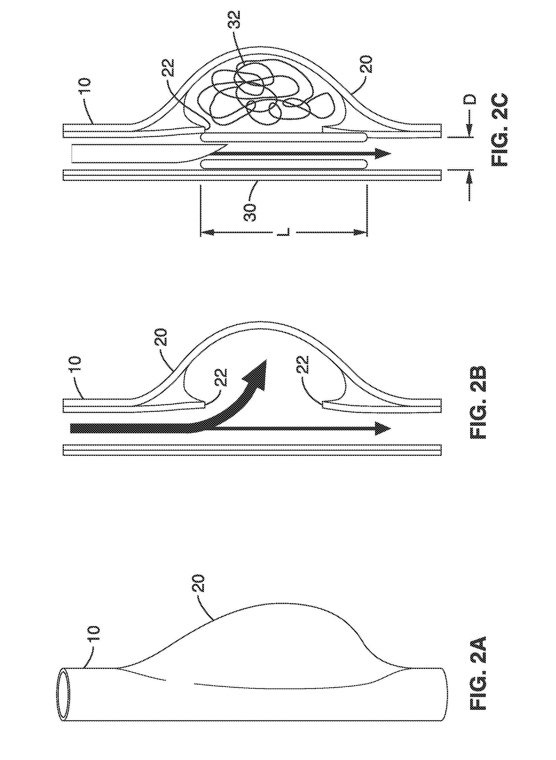 Thin film vascular stent and biocompatible surface treatment