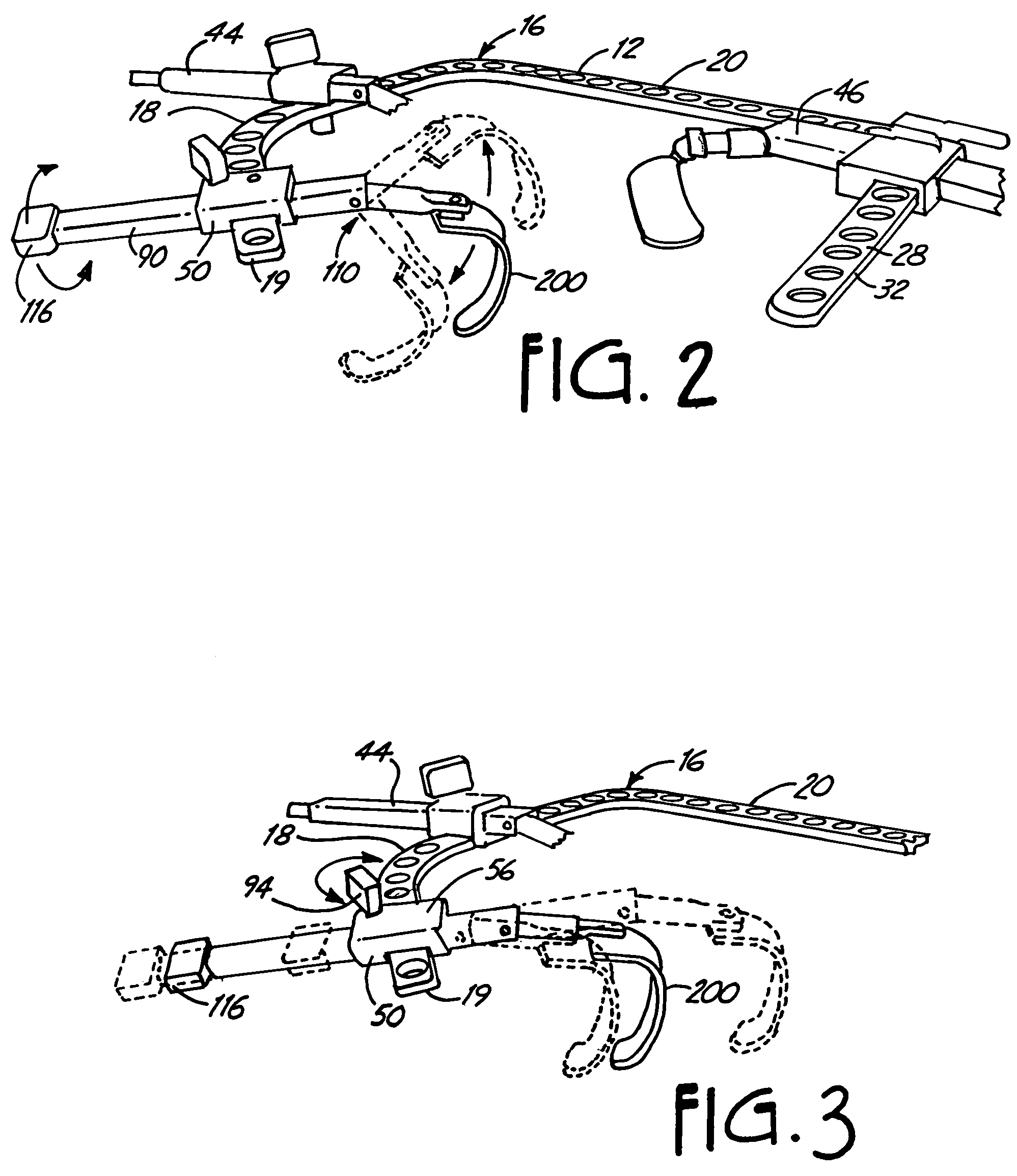 Method for humerus retraction