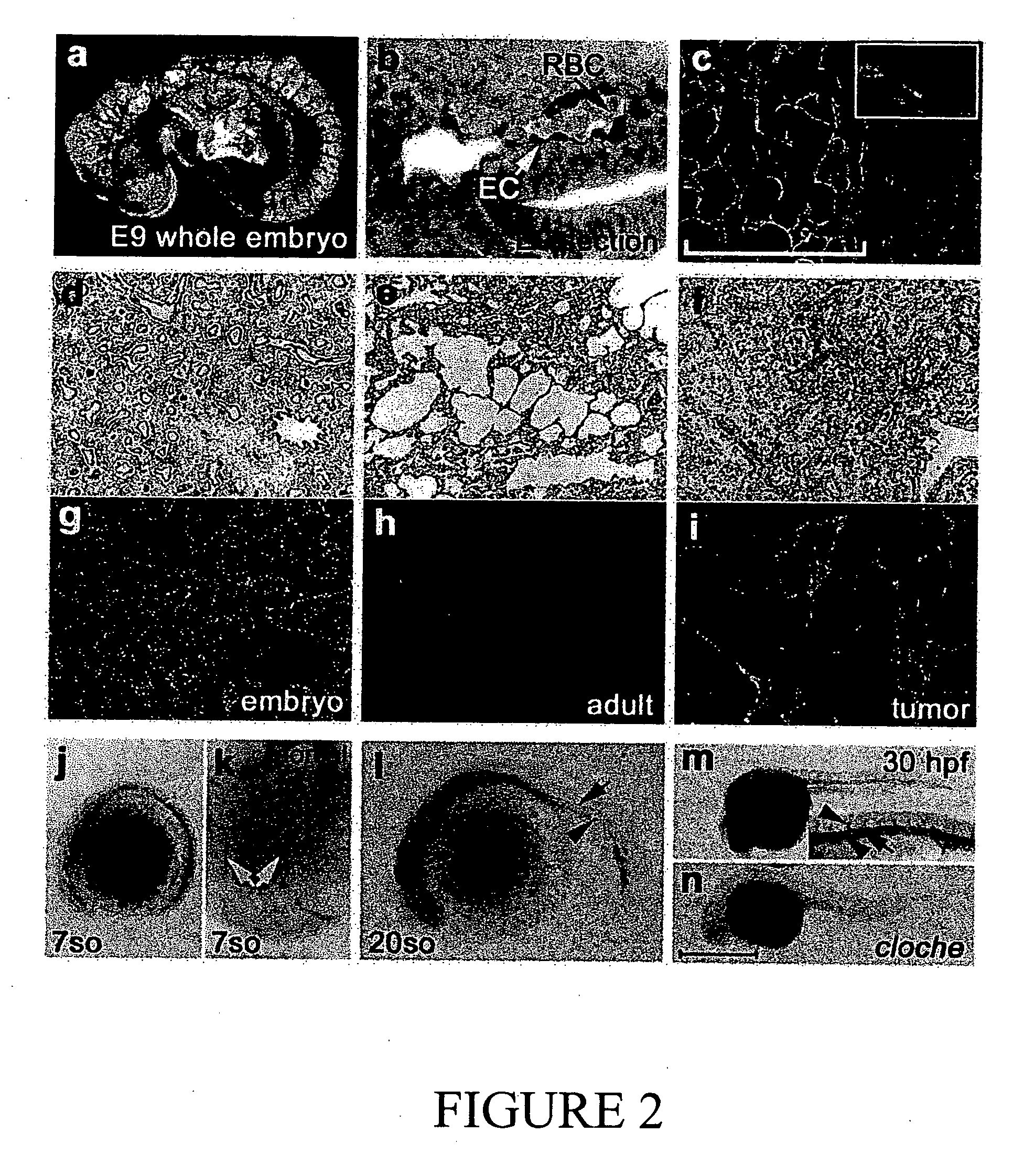 Compositions and methods for modulating vascular development