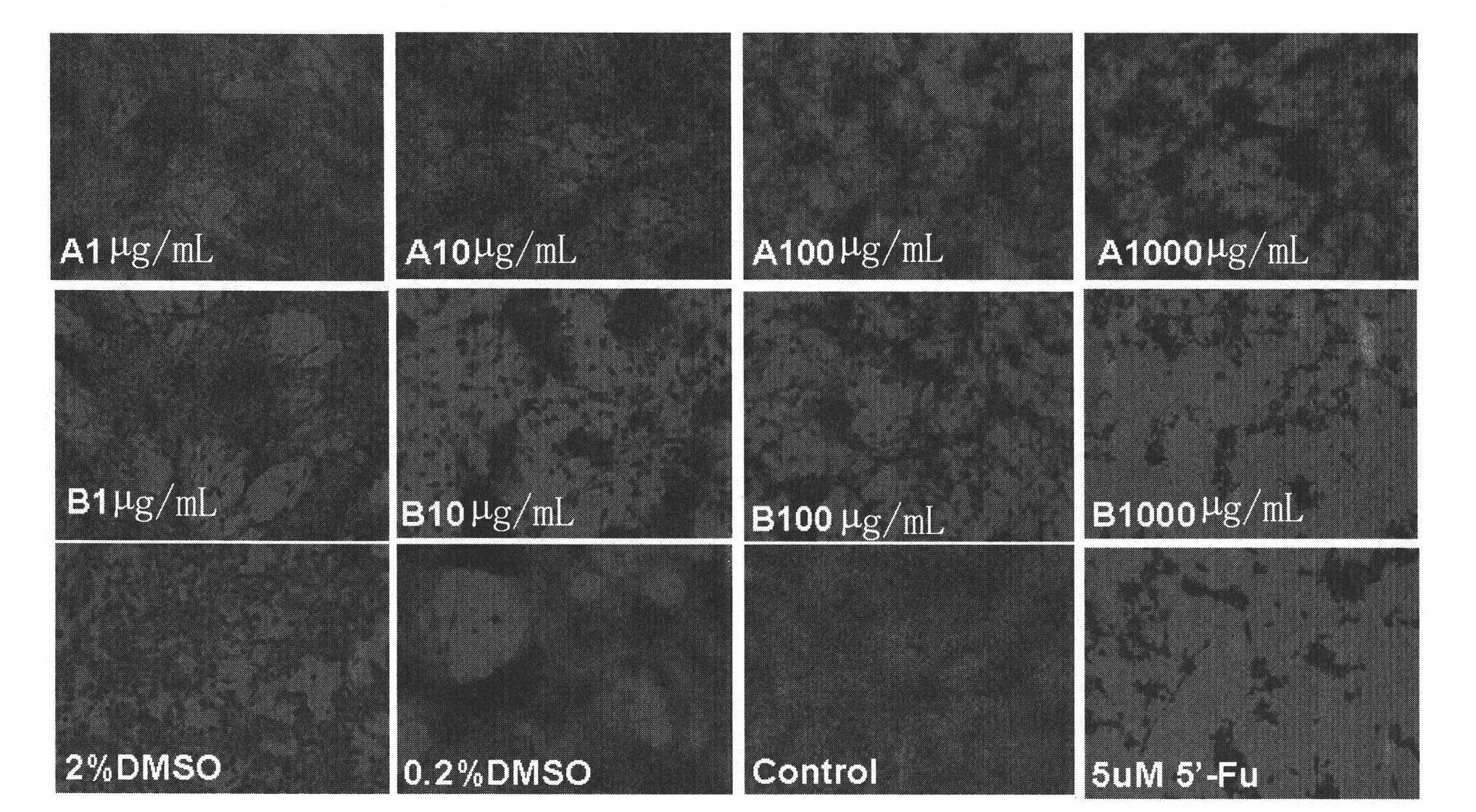 Application of ranunculus japonicus extract in preparing anti-tumor and anti-tumor angiogenesis drugs