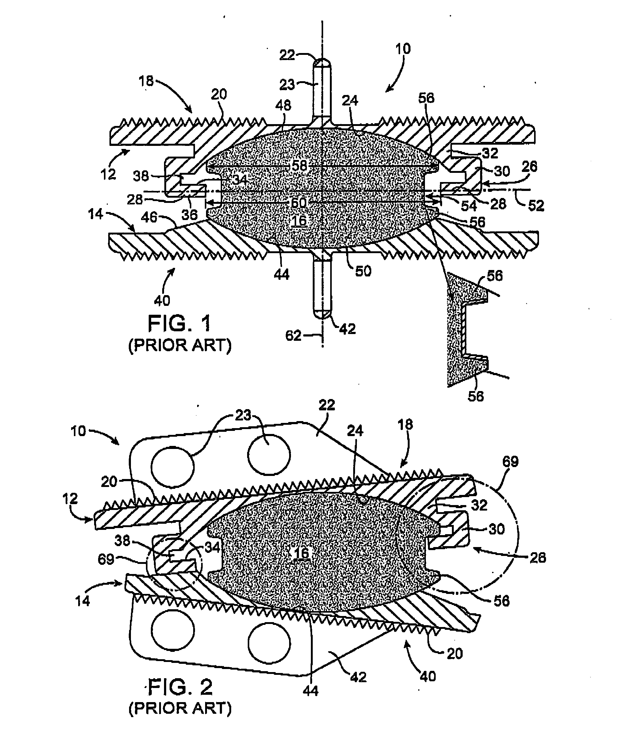 Intervertebral prosthetic disc with shock absorption