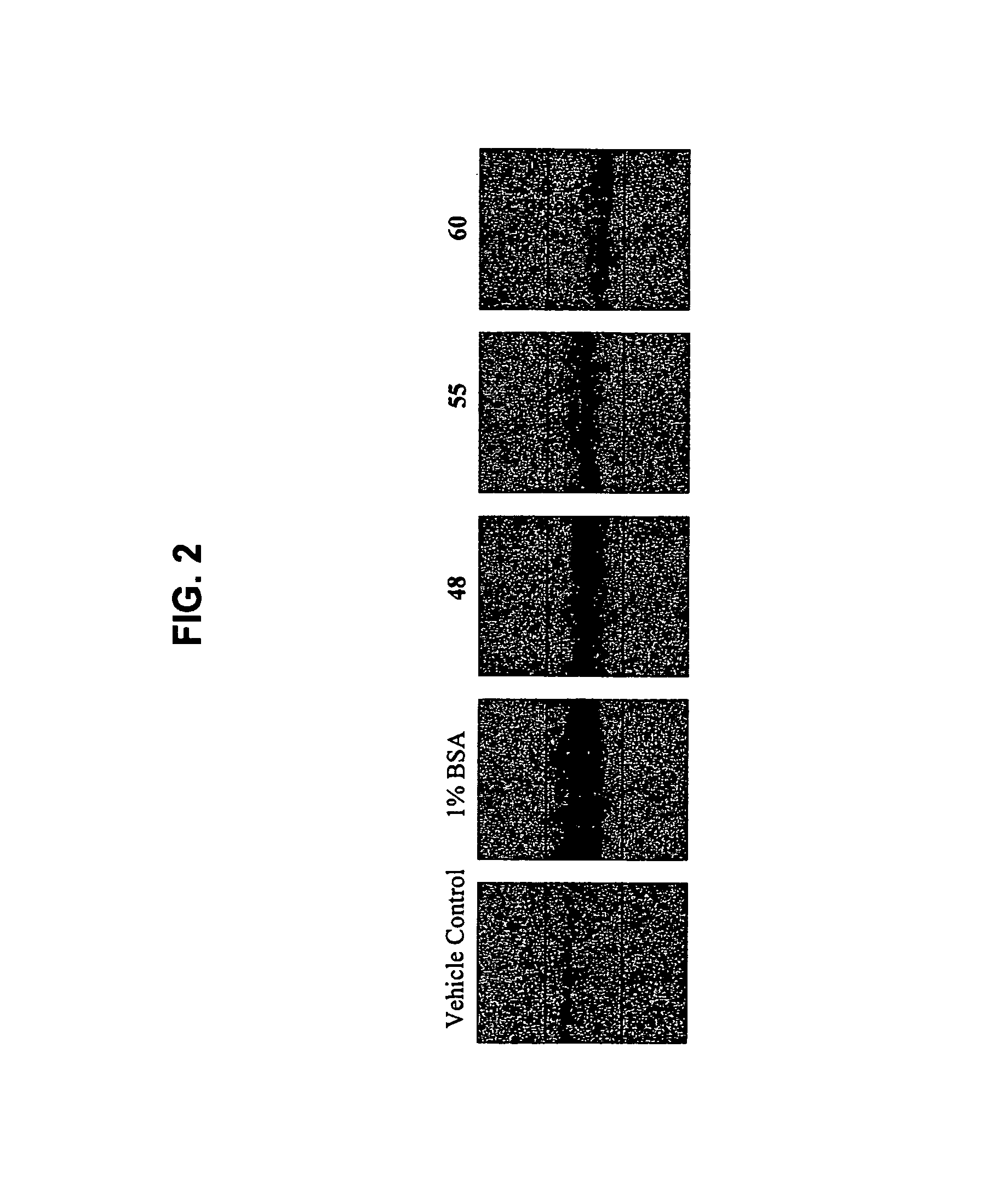 Migrastatin analogs in the treatment of cancer