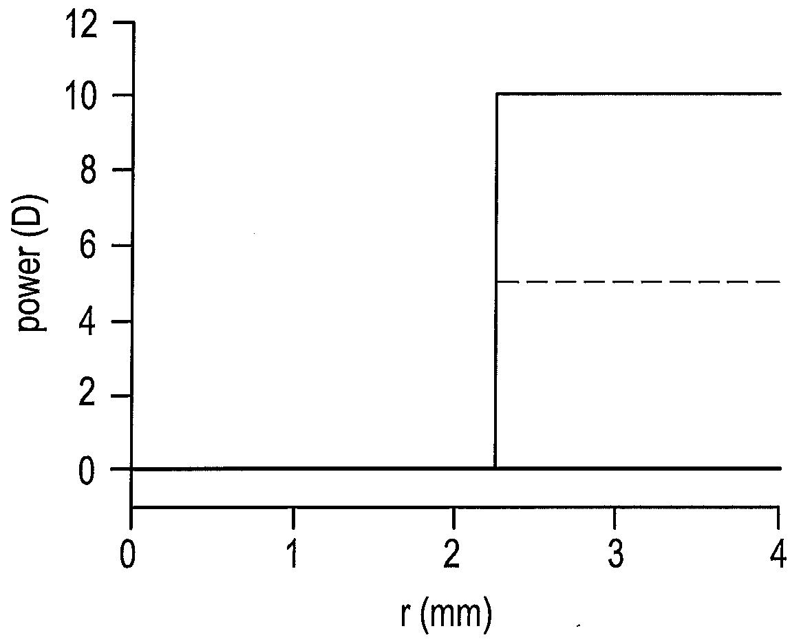 High plus treatment zone lens design and method for preventing and/or slowing myopia progression