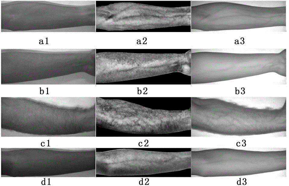 Vein imaging method for visible-light skin images