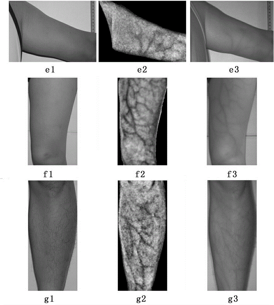 Vein imaging method for visible-light skin images