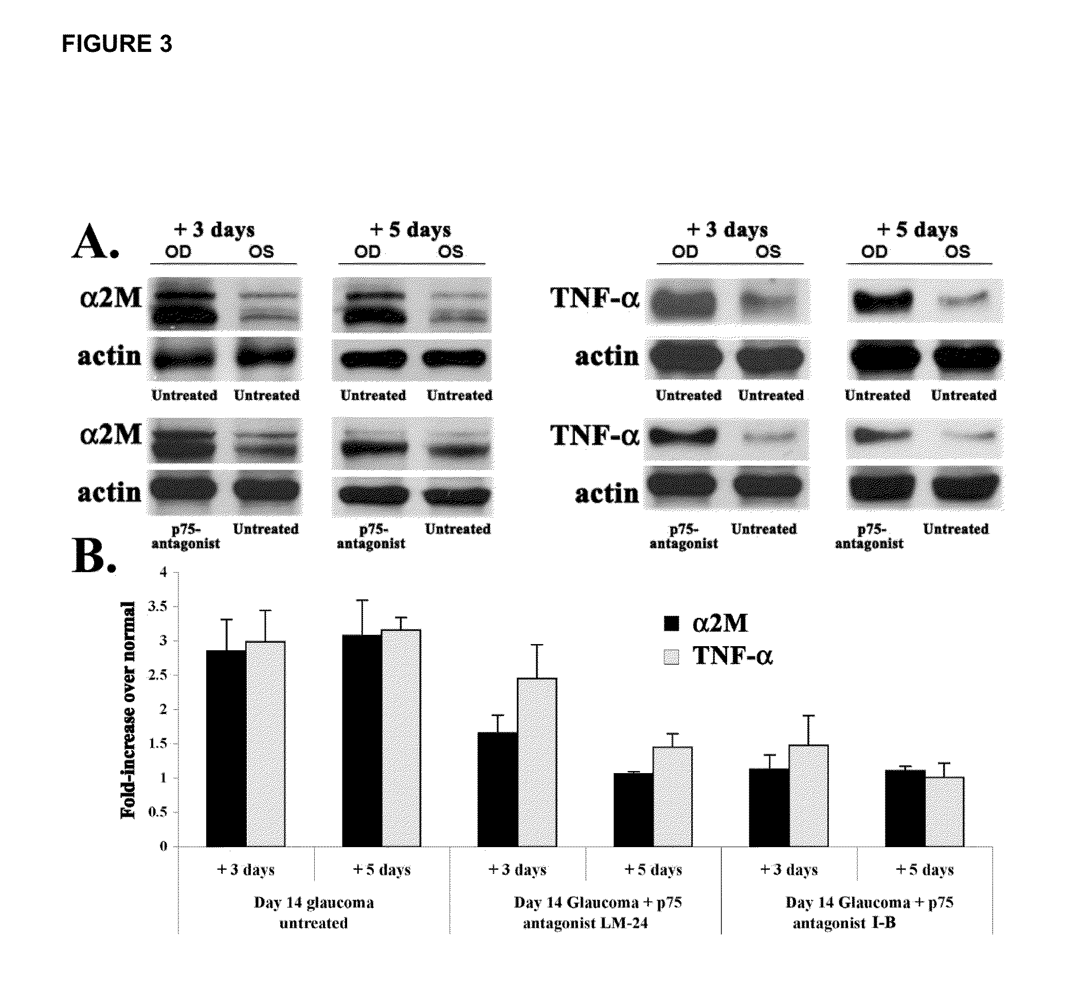 Inhibitors of p75 receptor and their uses