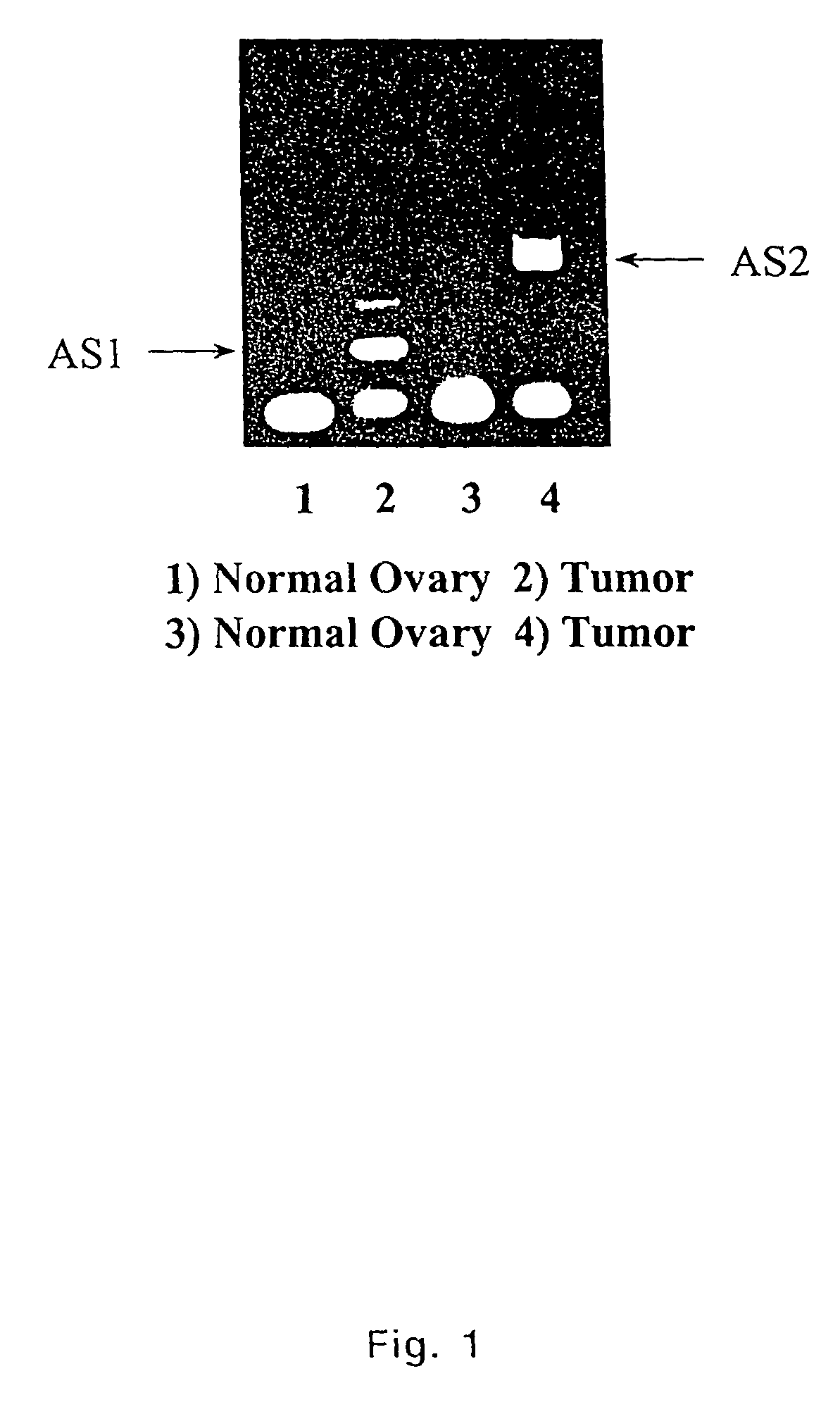 Extracellular serine protease