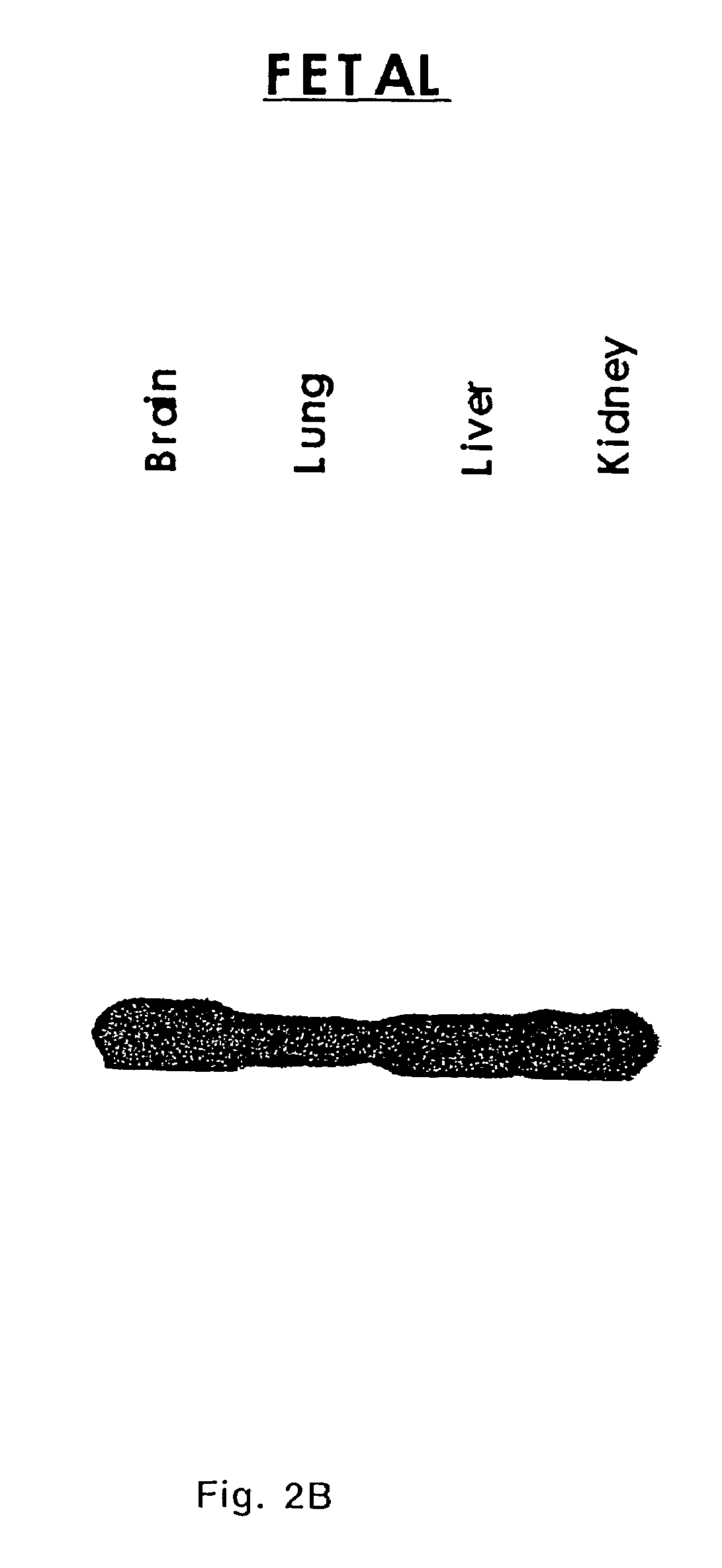 Extracellular serine protease