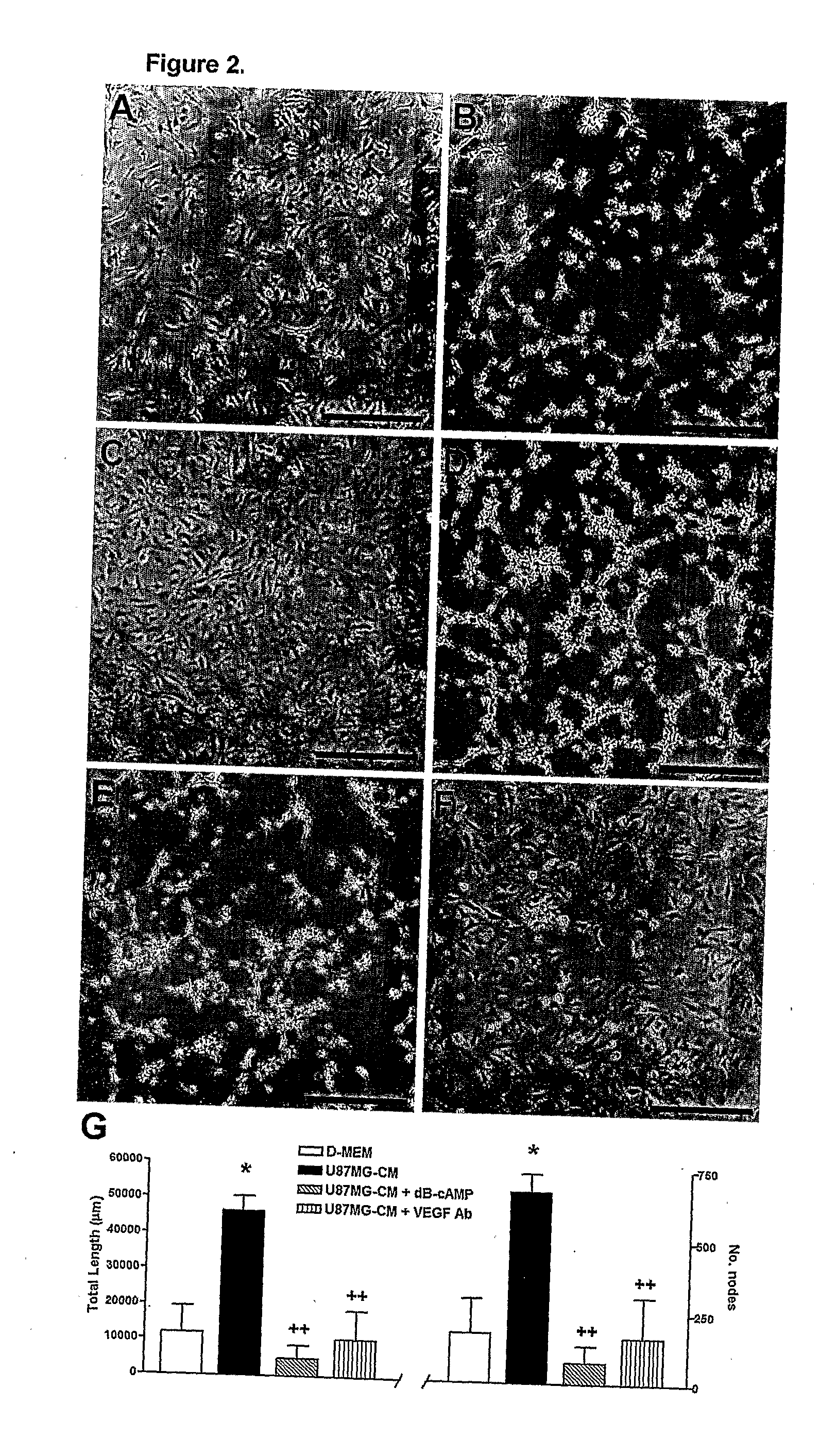 Insulin-Like Growth Factor Binding Protein-4 Compounds and Methods for Inhibiting Angiogenesis and Tumor Growth in Mammalian Cells