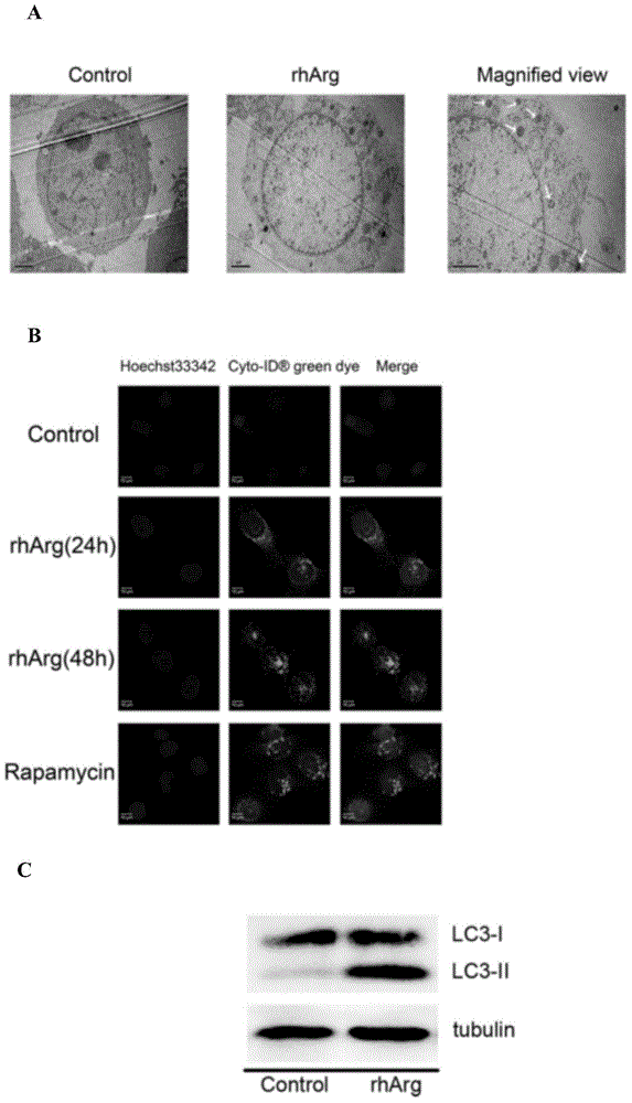 Preparation for combined treatment of head and neck neoplasms, and uses thereof