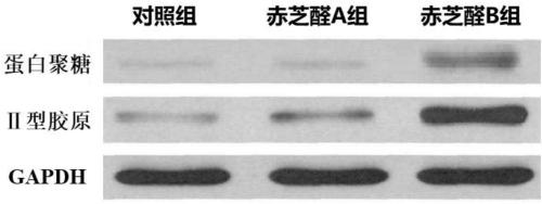A culture method and culture medium for inducing chondrogenic differentiation of fat stem cells