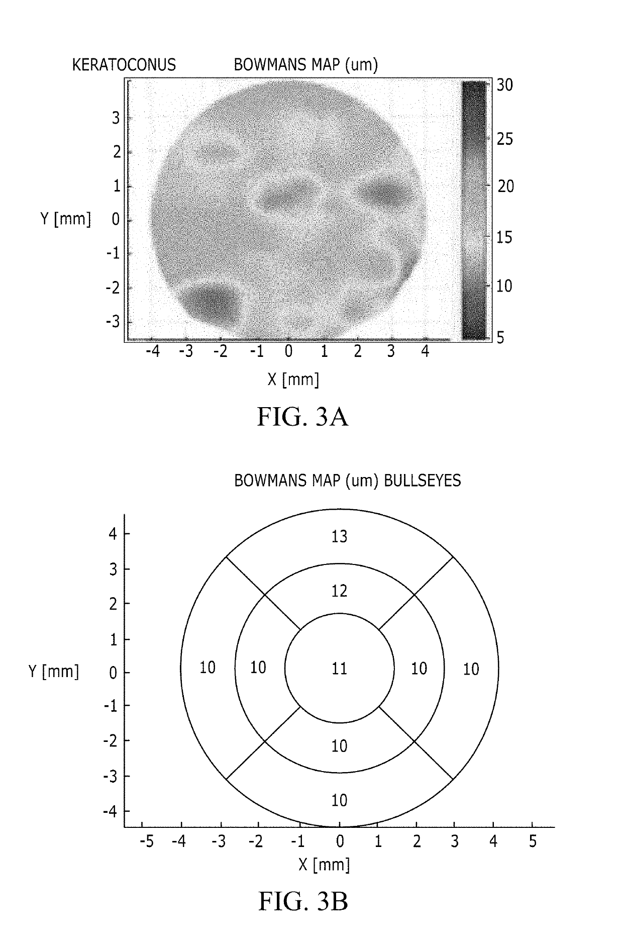 Method and system for three-dimensional thickness mapping of corneal micro-layers and corneal diagnoses