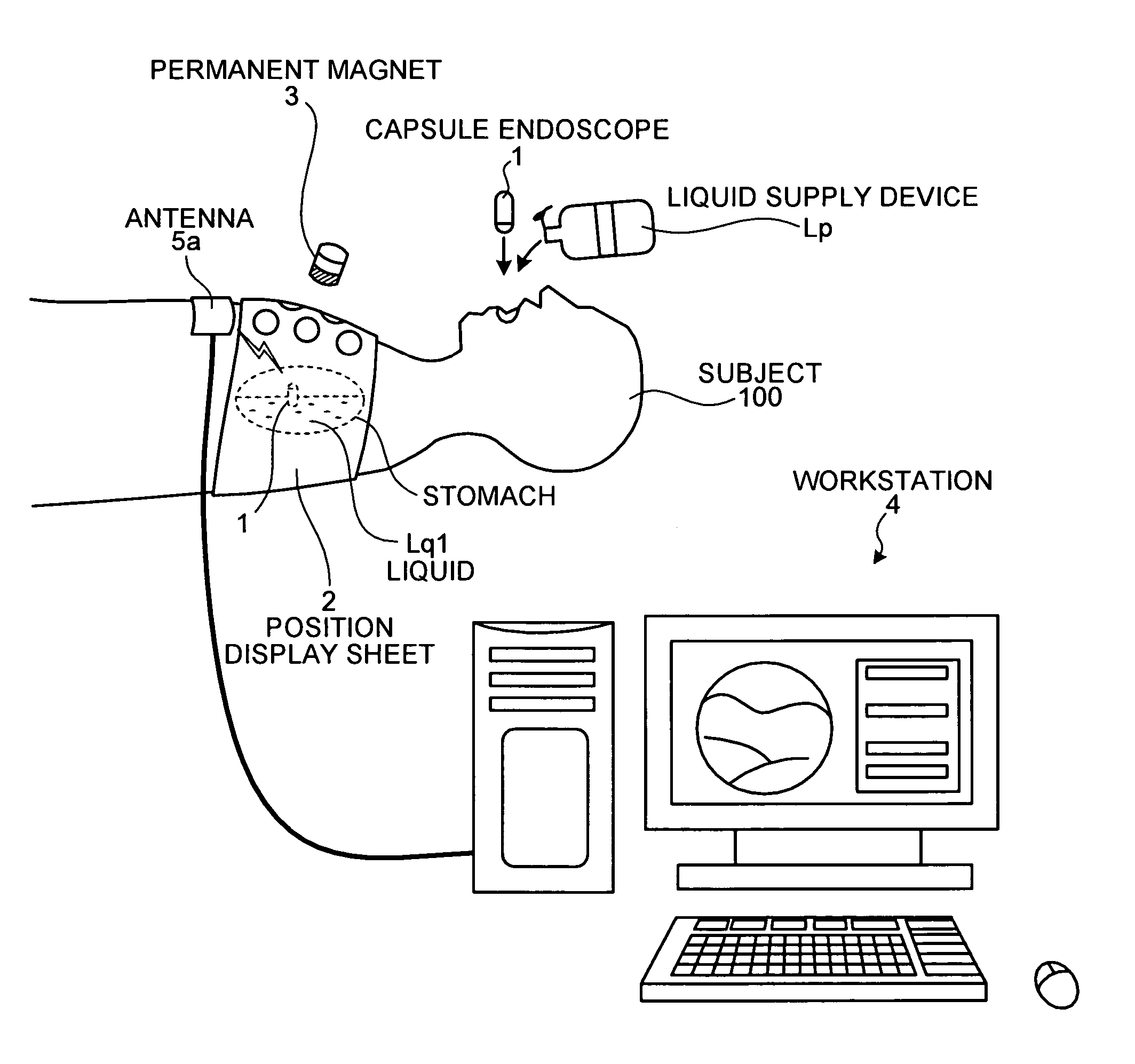 Body-insertable device system and body-insertable device guiding method