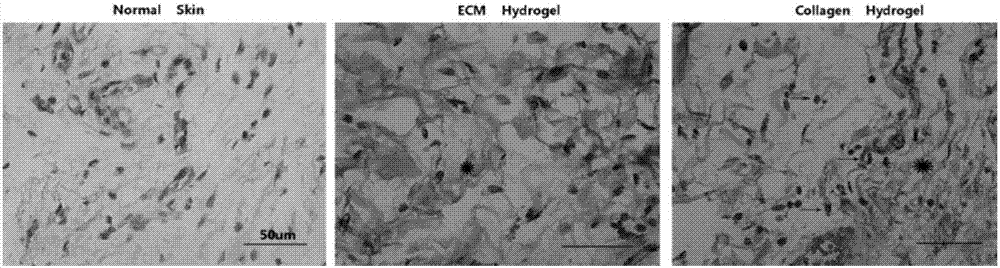 Preparation method and application of lung matrix hydrogel and medicine