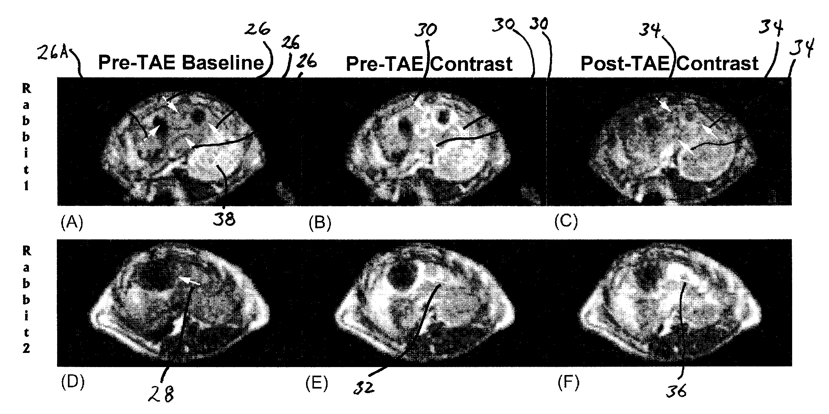 Method for transcatheter intra-arterial perfusion magnetic resonance imaging