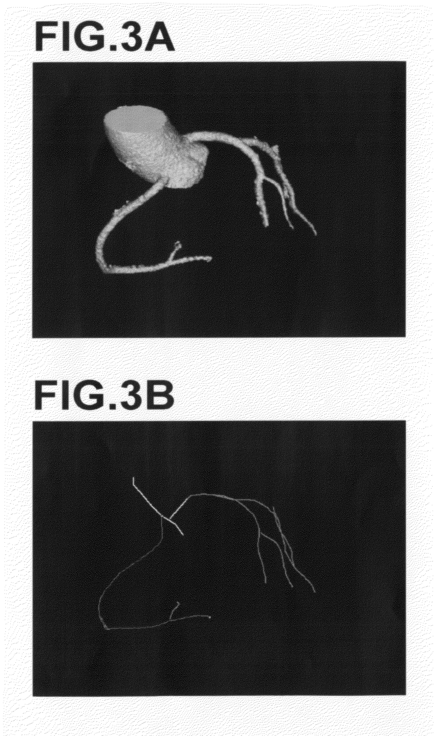 Image display method, apparatus, and program