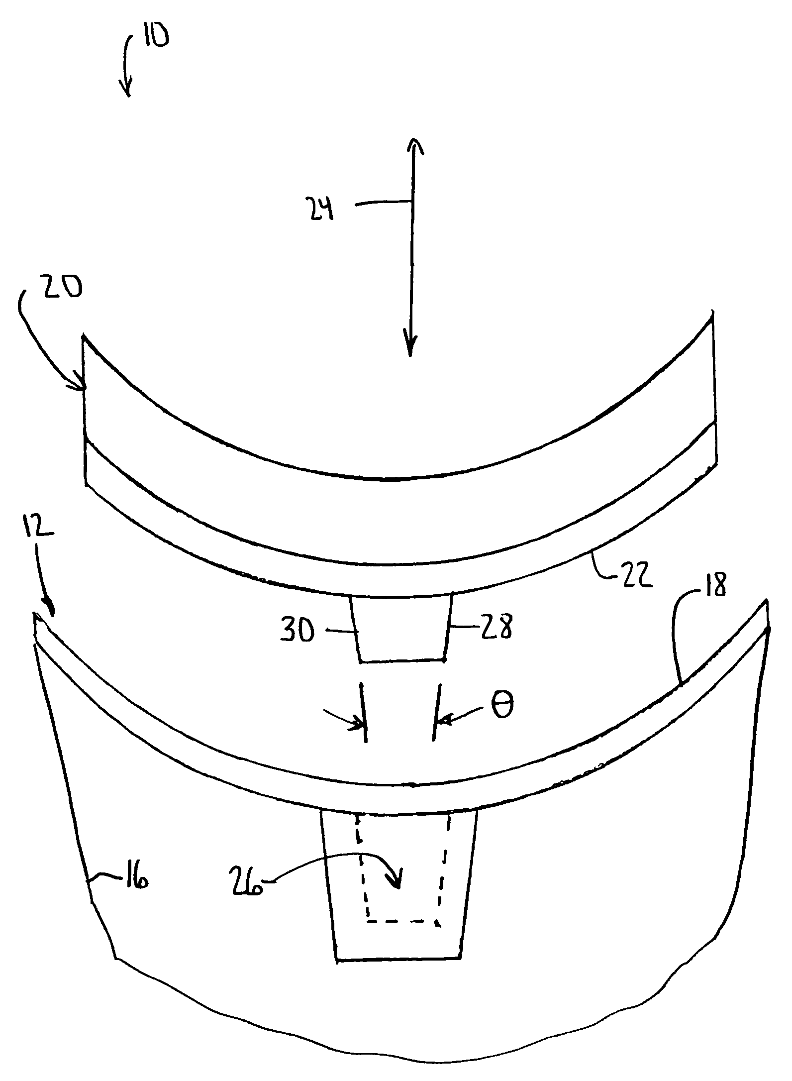 Modular glenoid prosthesis and associated method