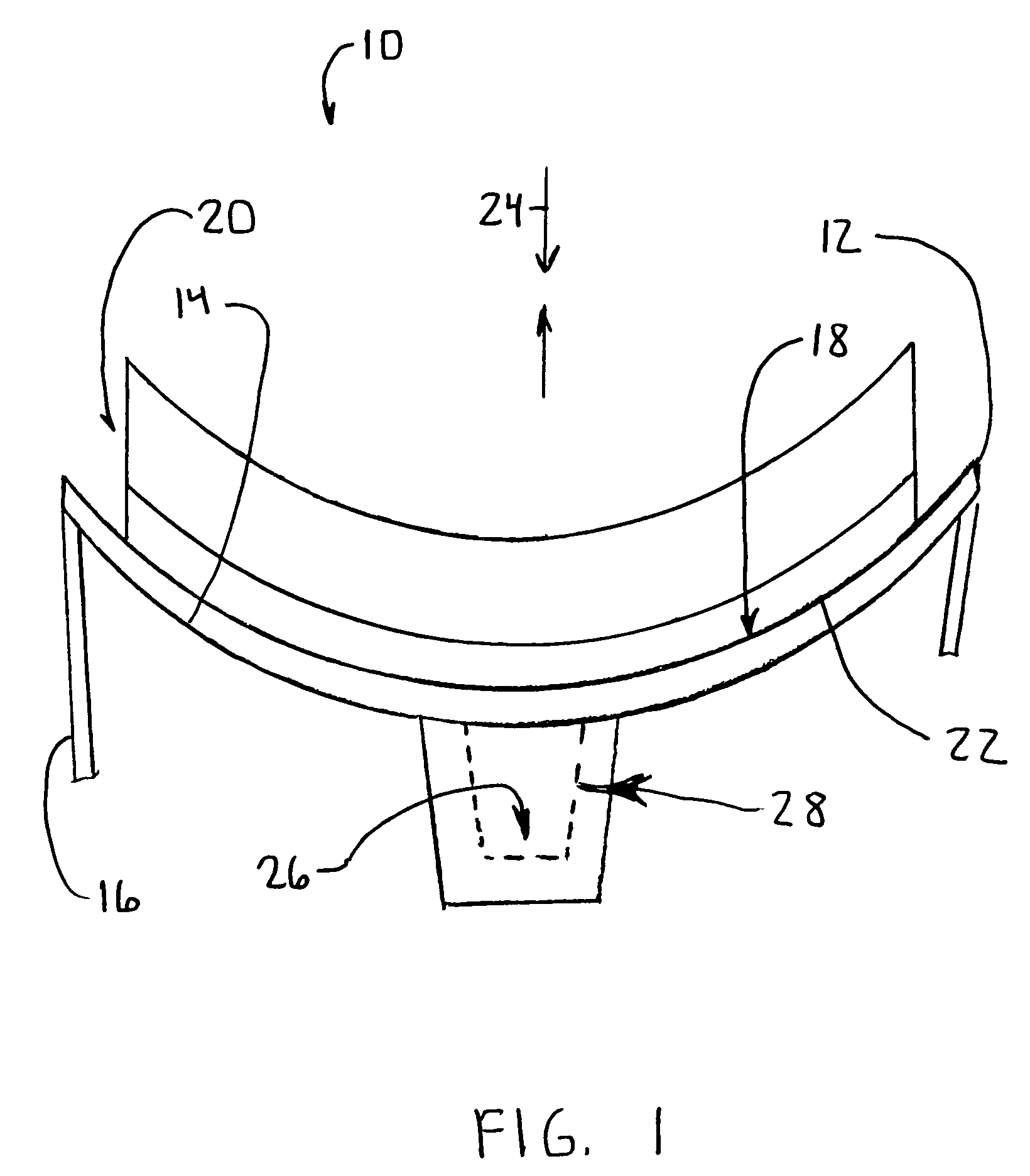 Modular glenoid prosthesis and associated method