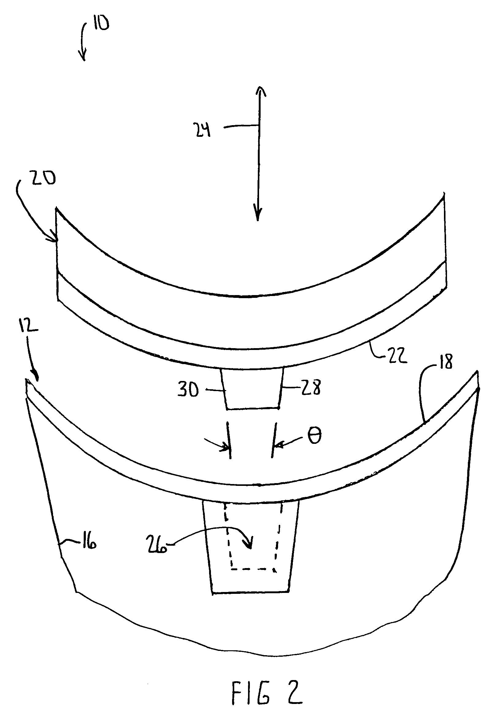 Modular glenoid prosthesis and associated method