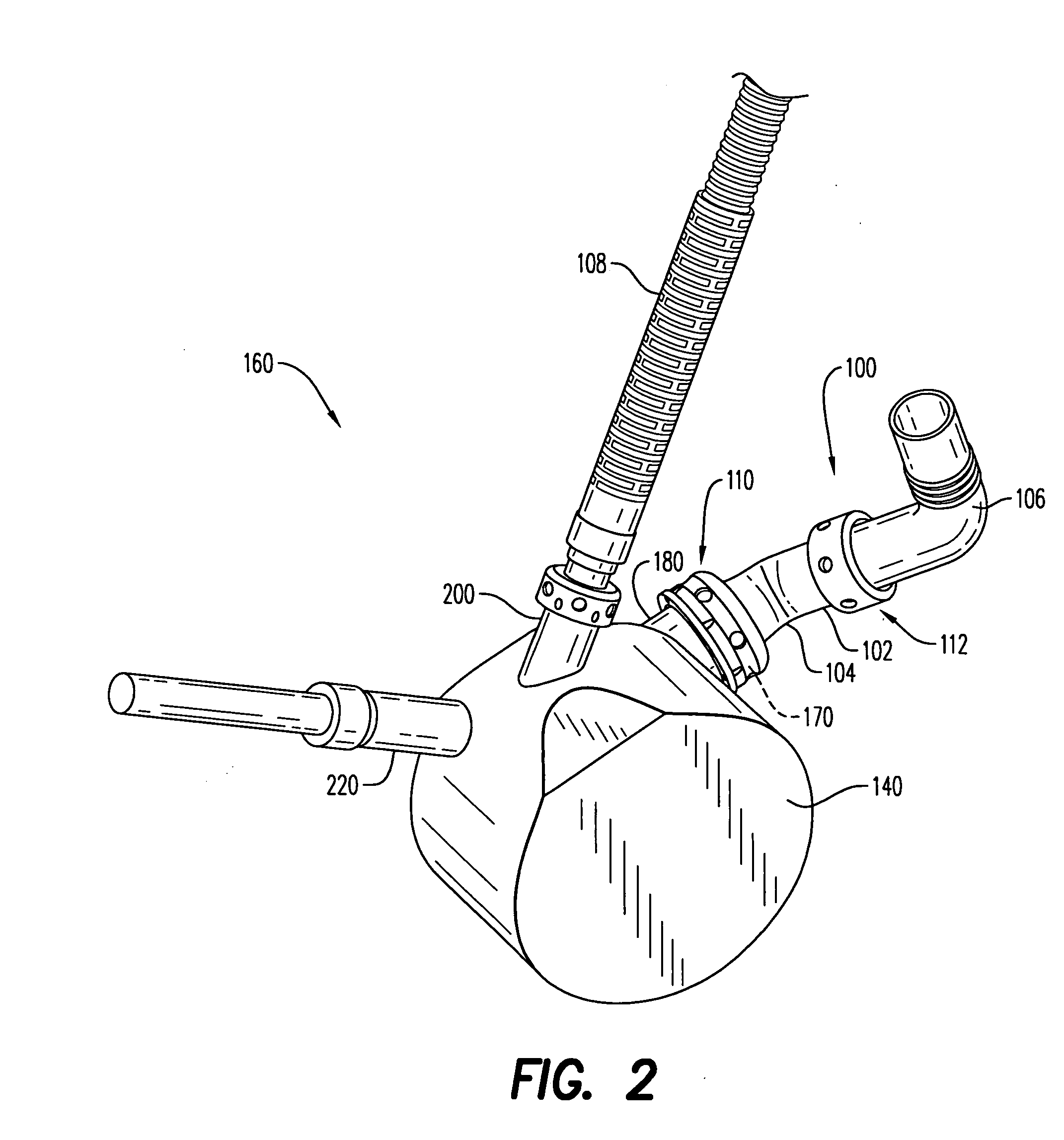 Adjustable coupling mechanism for the conduit on a ventricular assist device