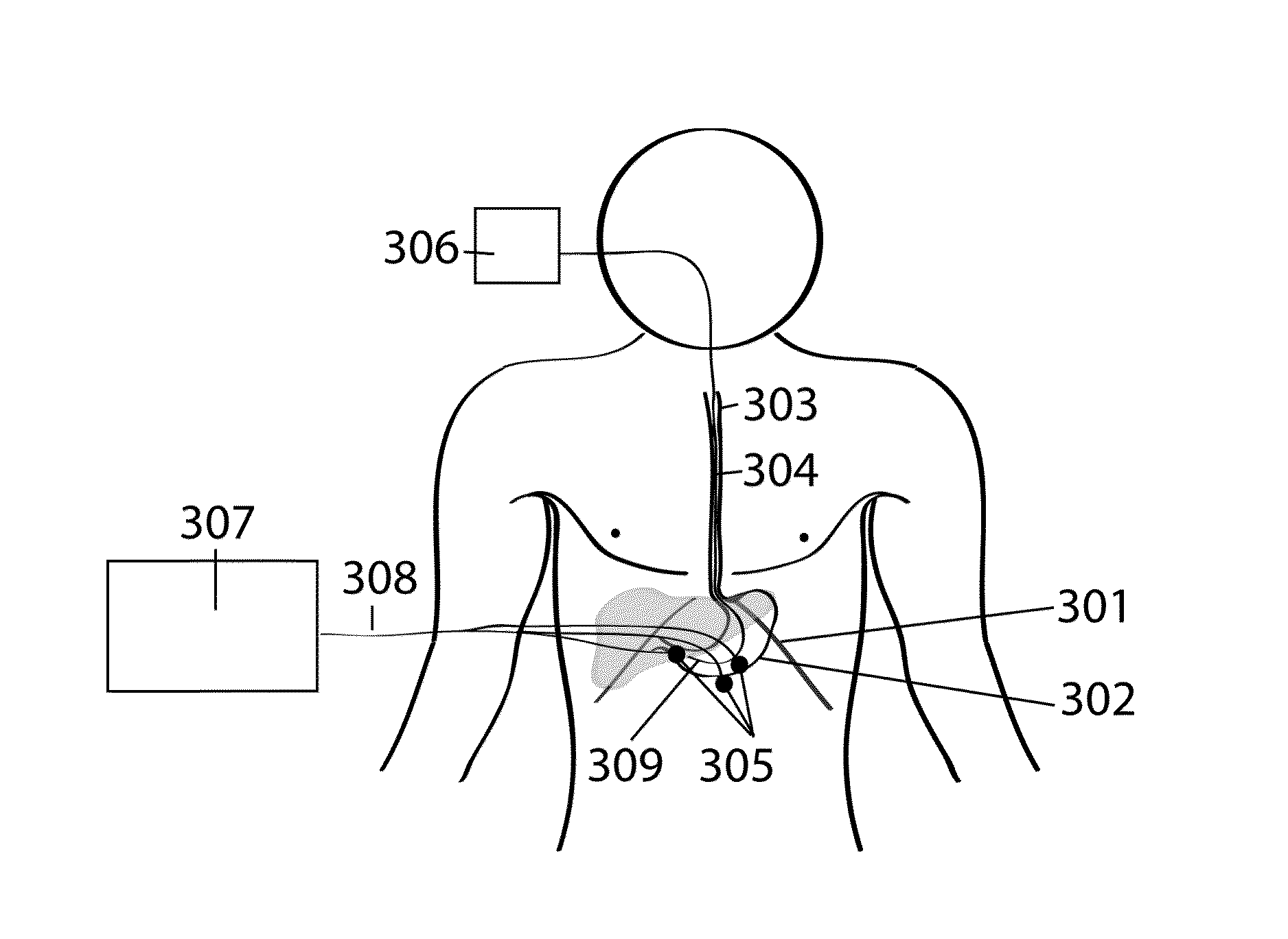 Device and method for monitoring internal organs