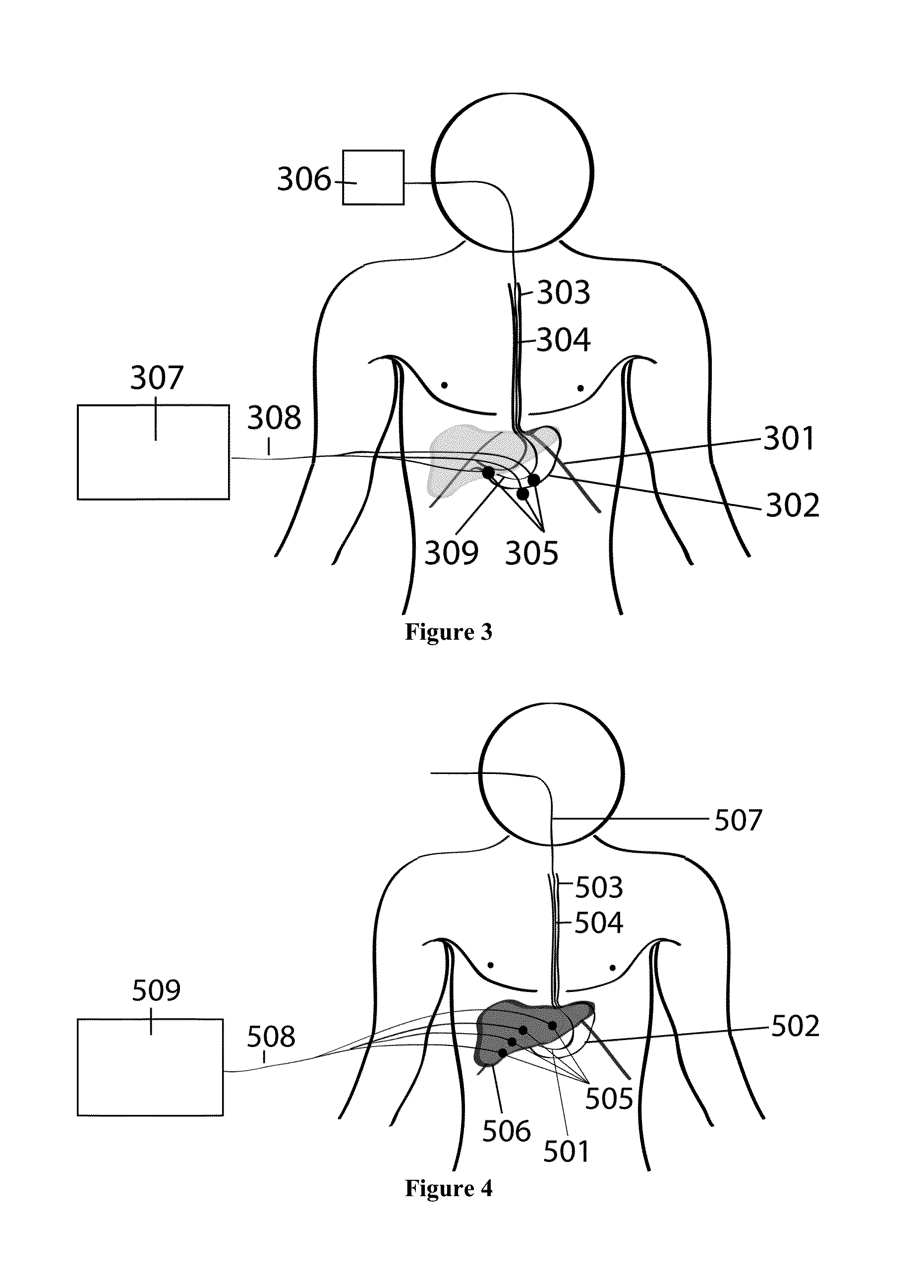 Device and method for monitoring internal organs