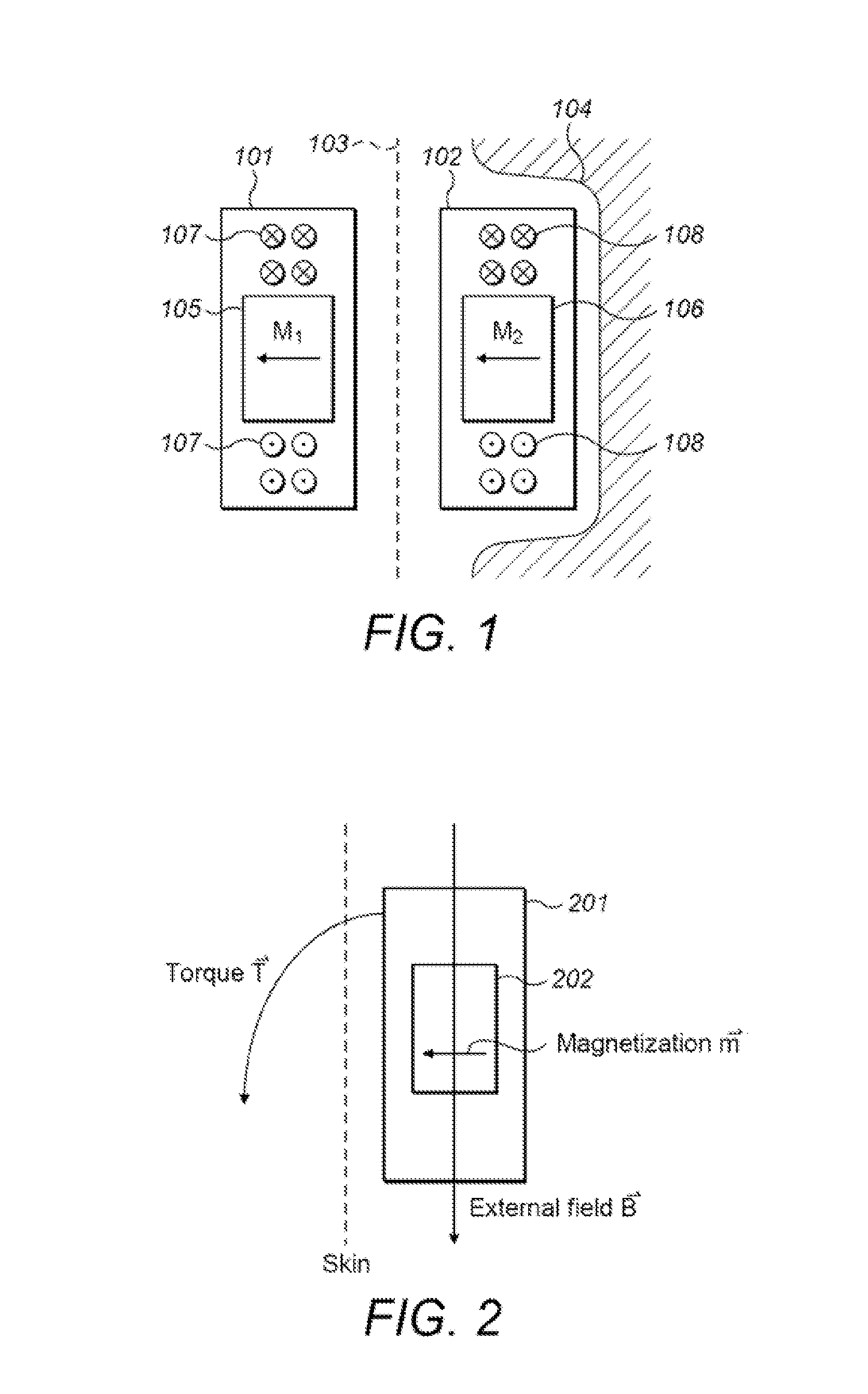 Symmetric Magnet Arrangement for Medical Implants