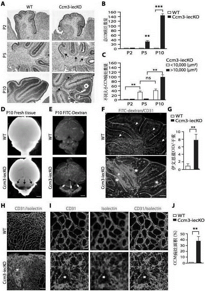 Application of ANGPT2 inhibitor in preparation of drug for treating hemangiomas