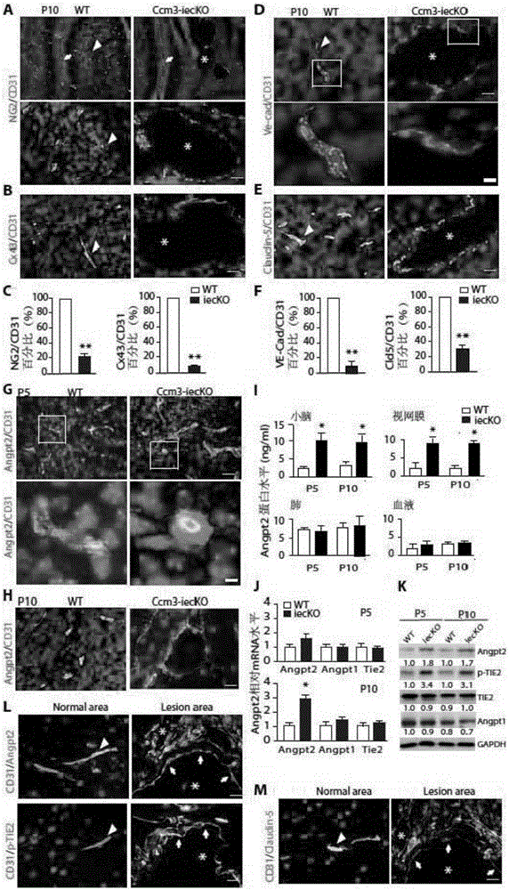 Application of ANGPT2 inhibitor in preparation of drug for treating hemangiomas