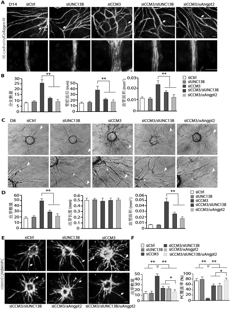 Application of ANGPT2 inhibitor in preparation of drug for treating hemangiomas