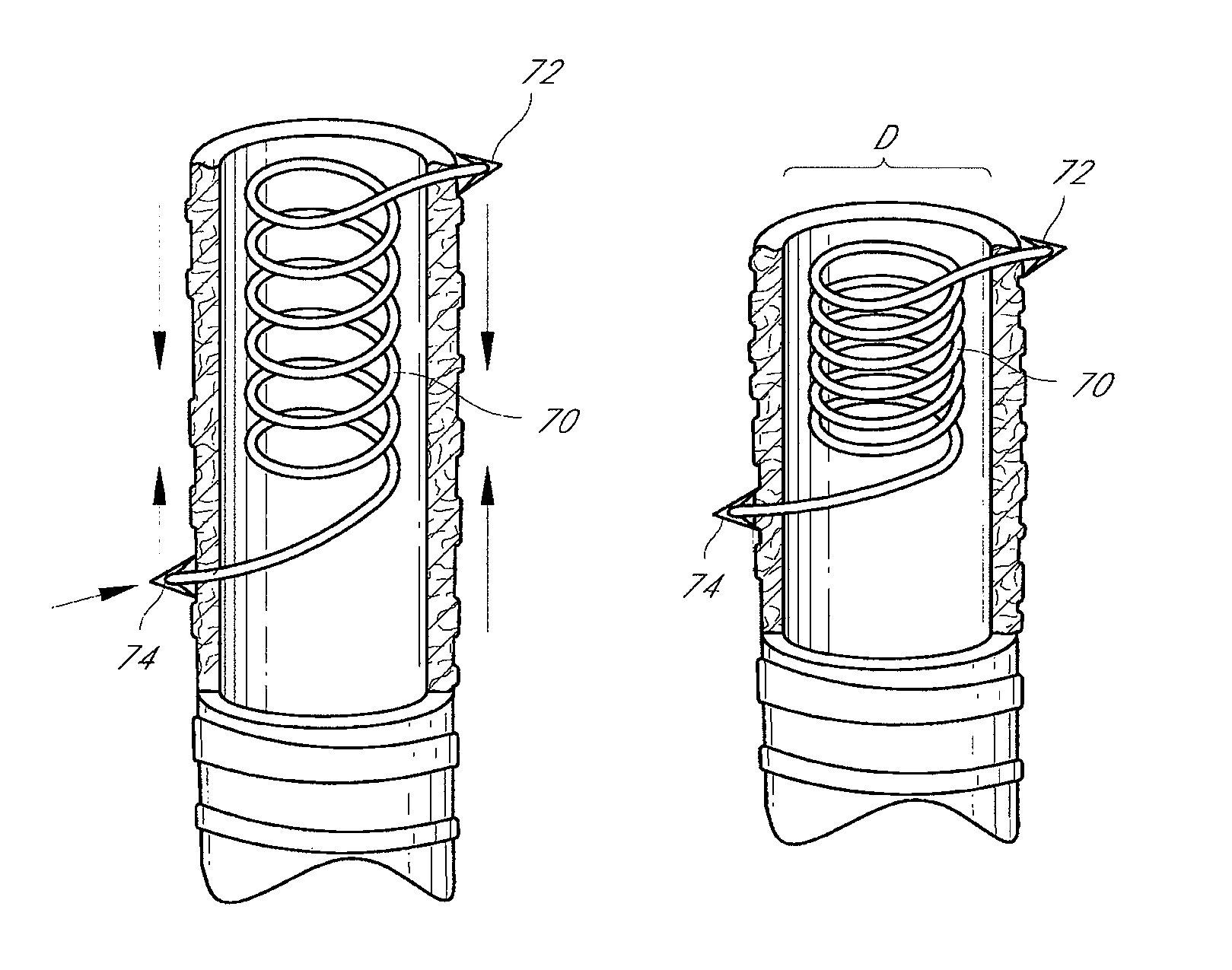 System and method for airway manipulation