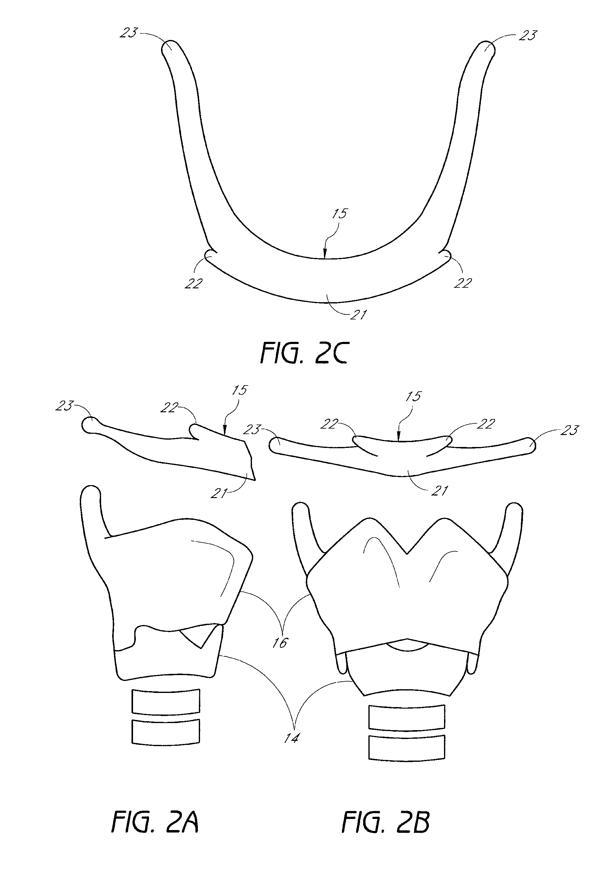 System and method for airway manipulation