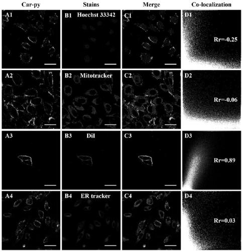 No-clean cell membrane targeting fluorescent probe and preparation method and application thereof