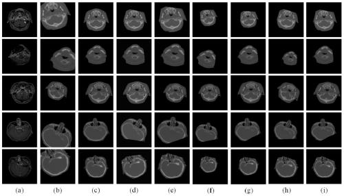 Medical image multi-modal registration method based on space-time intelligent agent