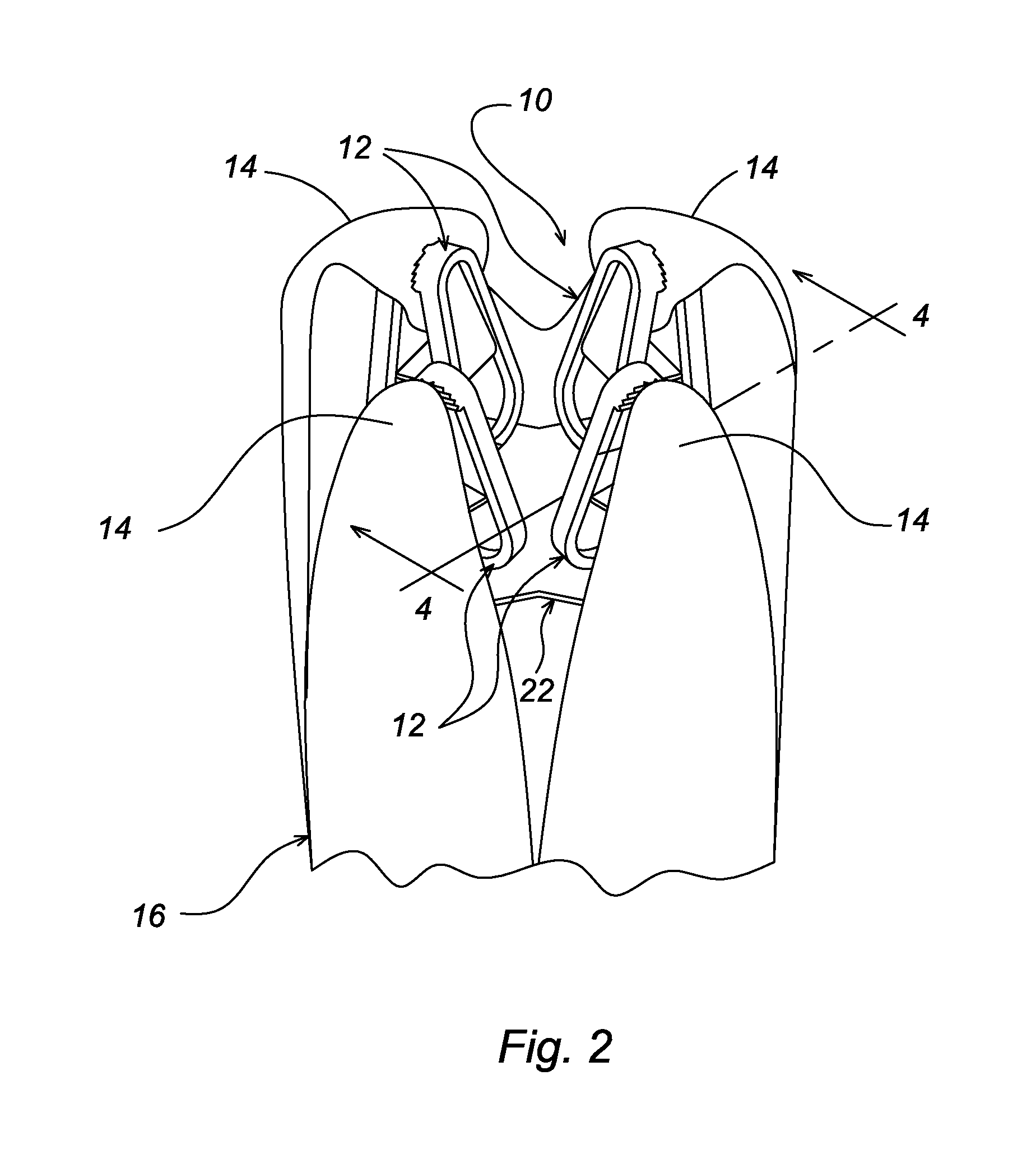 Laundry retainer for bed sheets