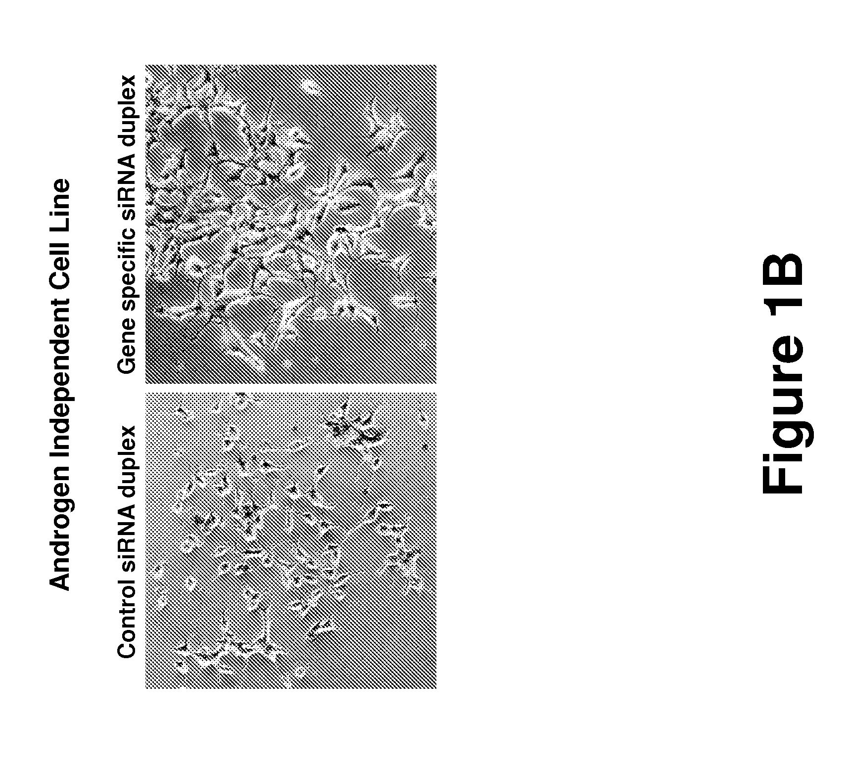 Methods to determine androgen responses in prostate cells