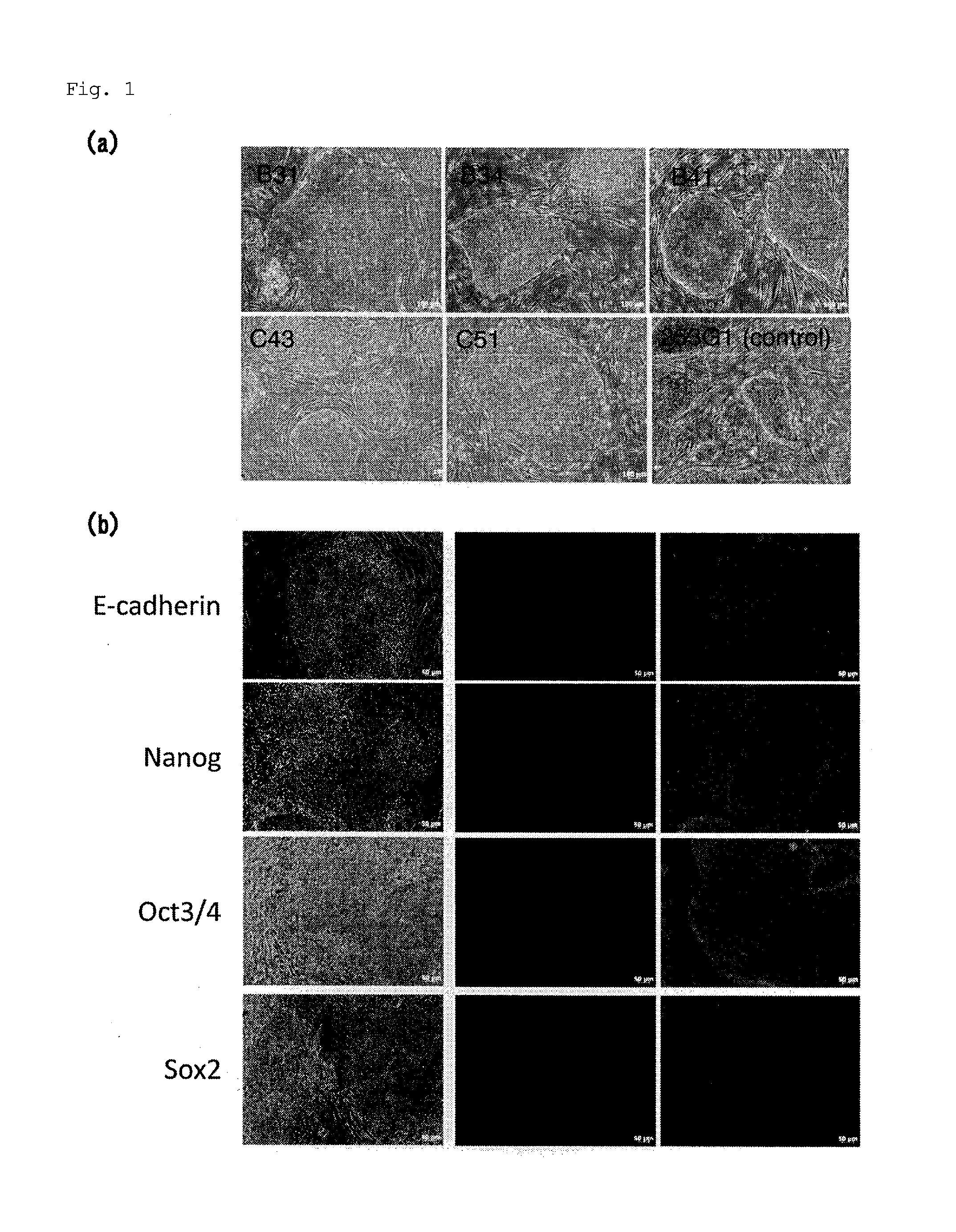 iPS CELL HAVING DIFFERENTIATION PROPENSITY FOR CORNEAL EPITHELIUM